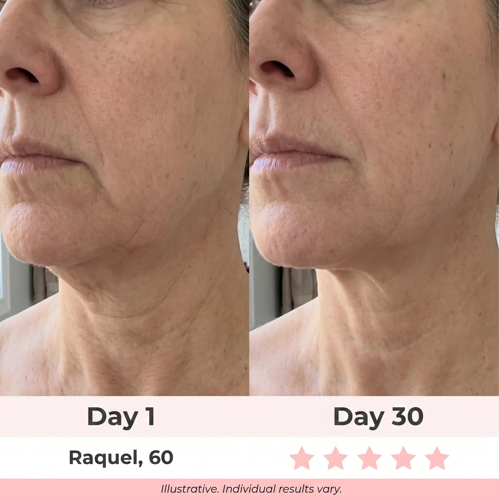 Before & after — Raquel, 60