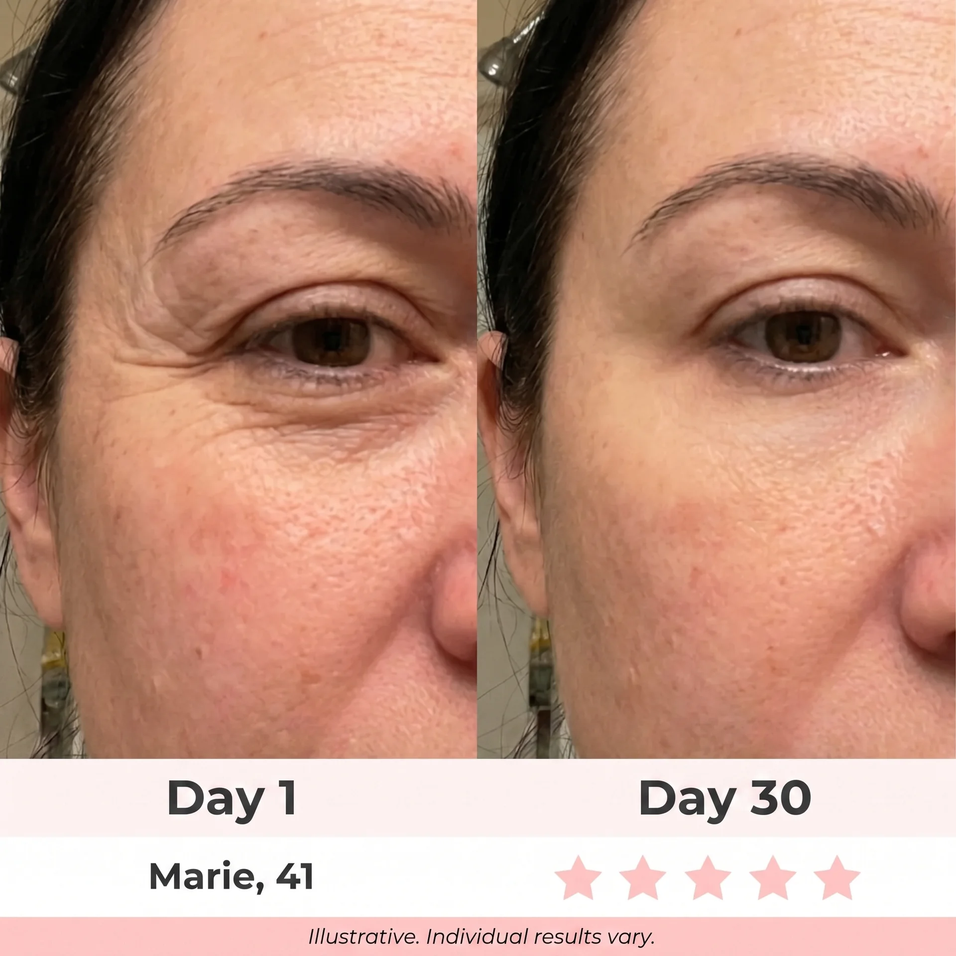Before & after — Marie, 41