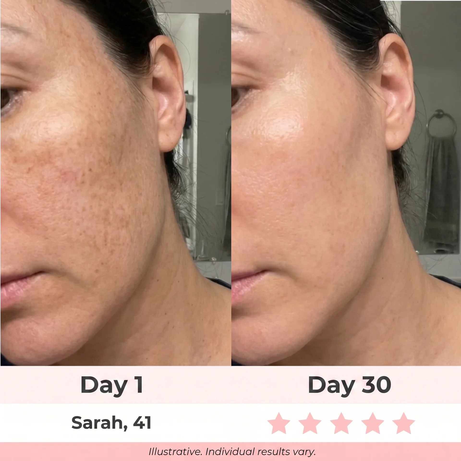 Before & after — Sarah, 41