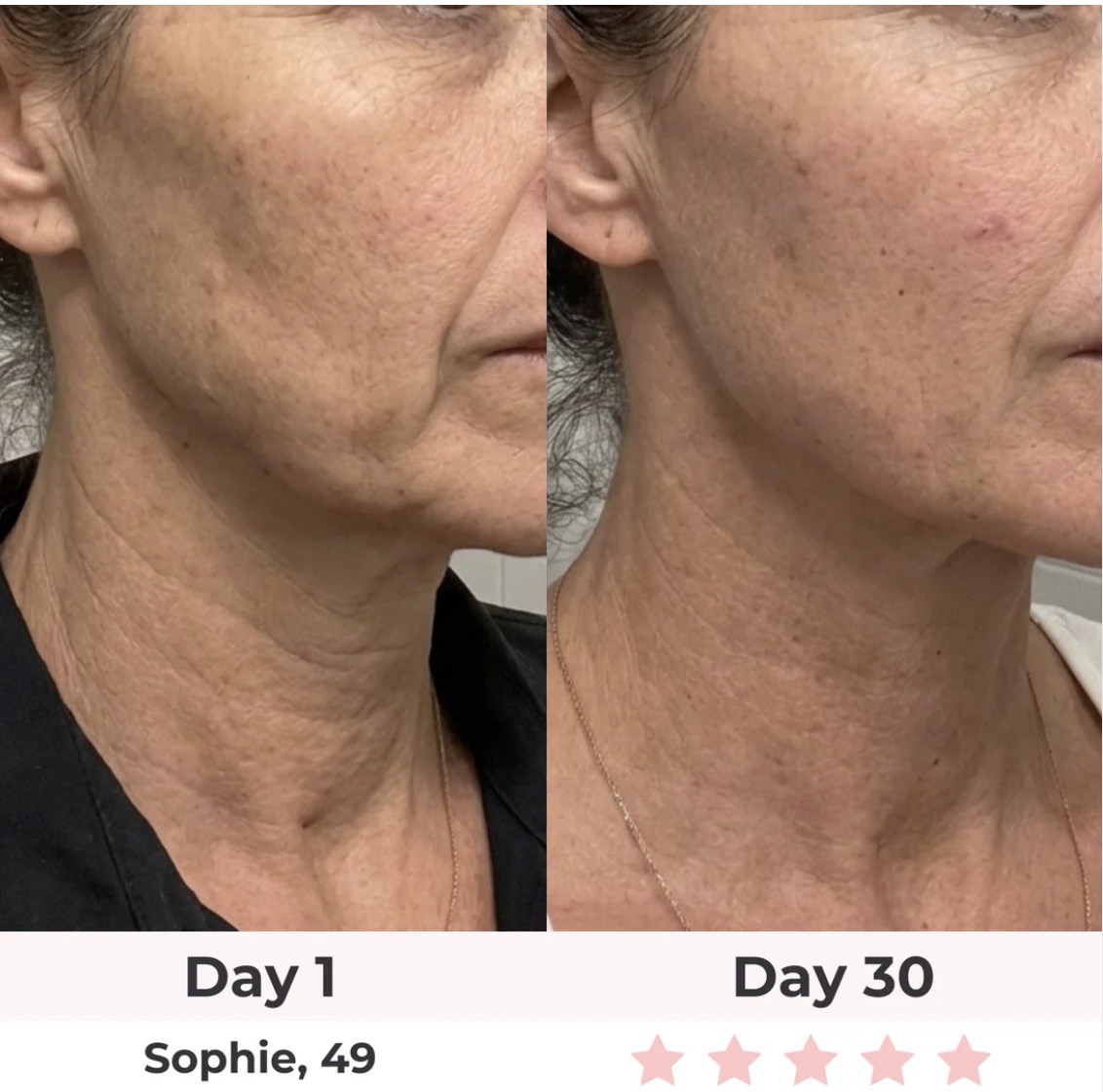 Before & after